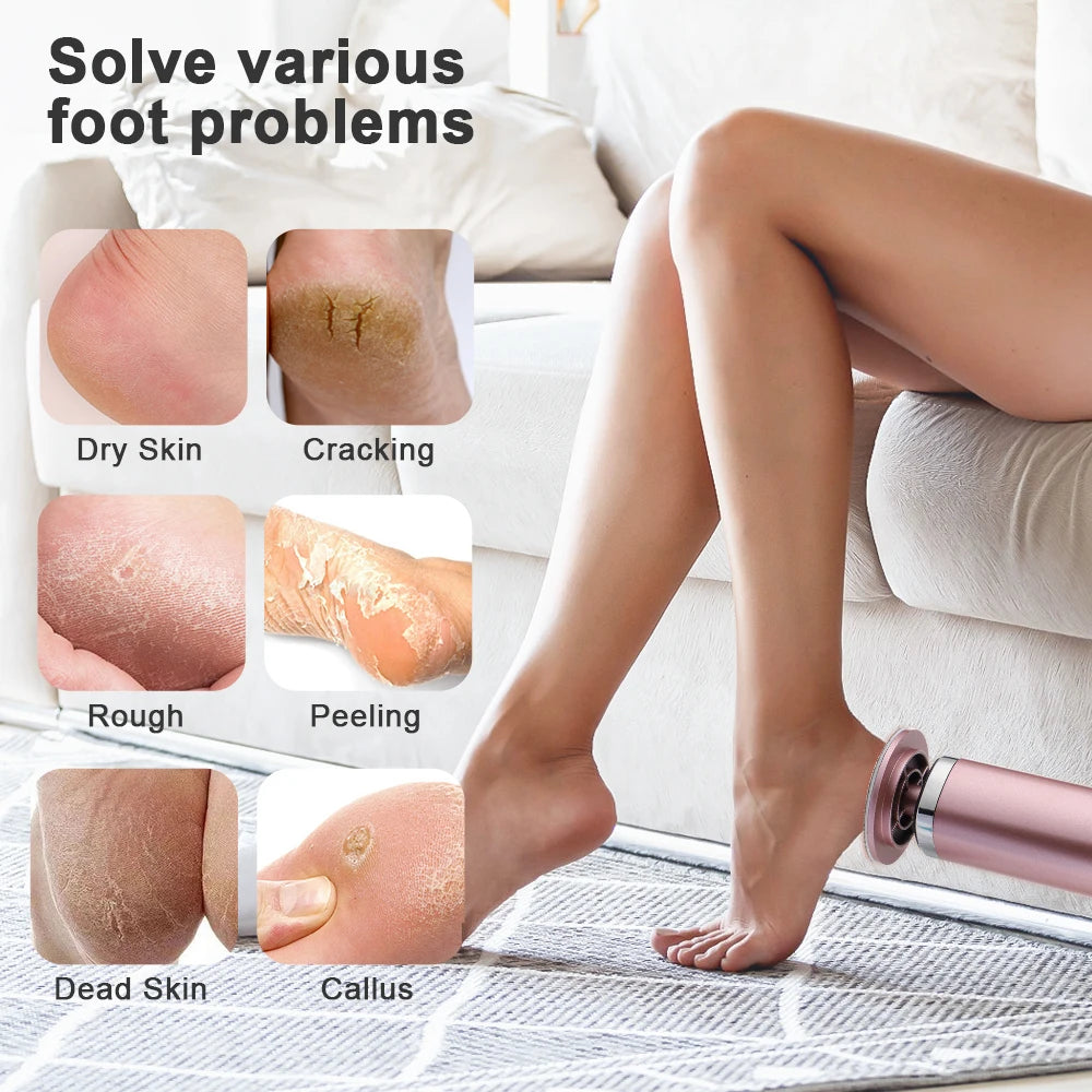 Eletric Foot Callus Remover